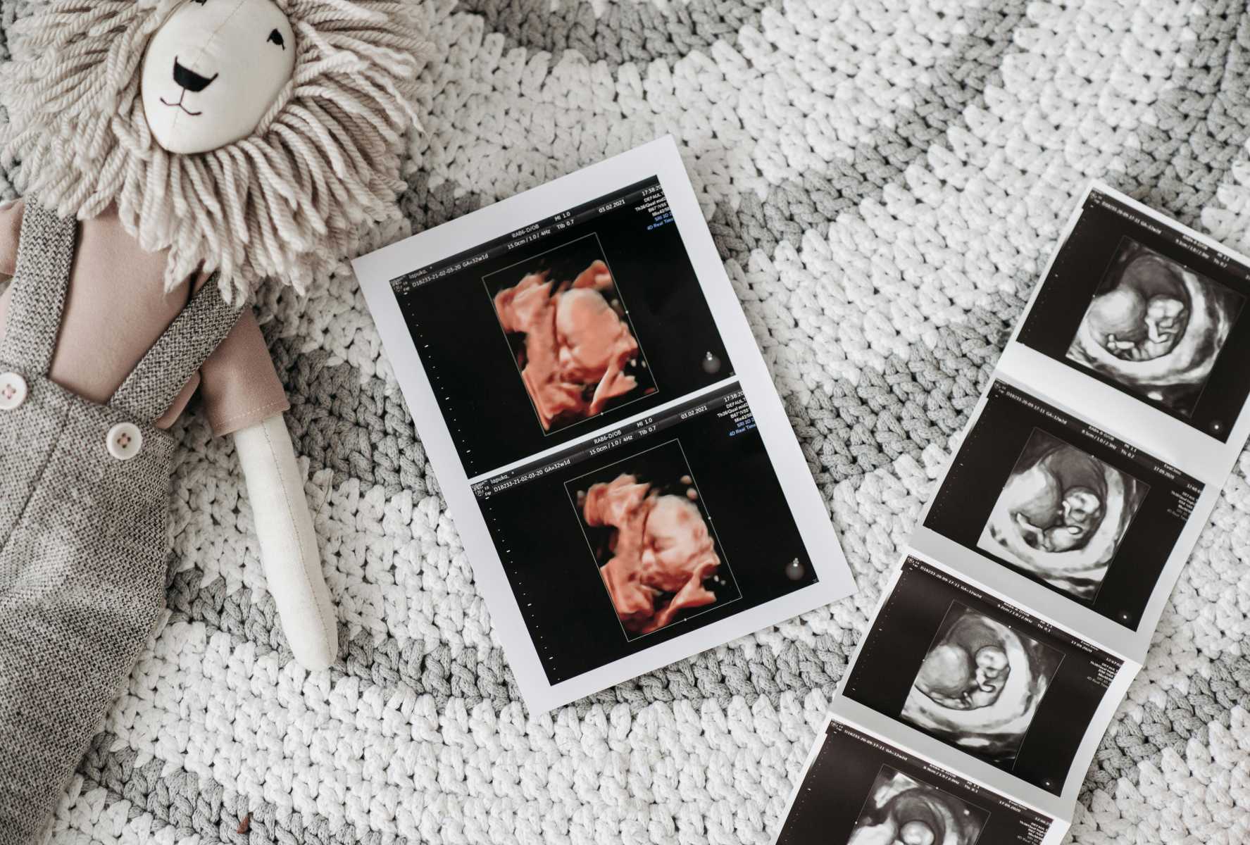 Sprievodca tehotenstvom s gynekologičkou