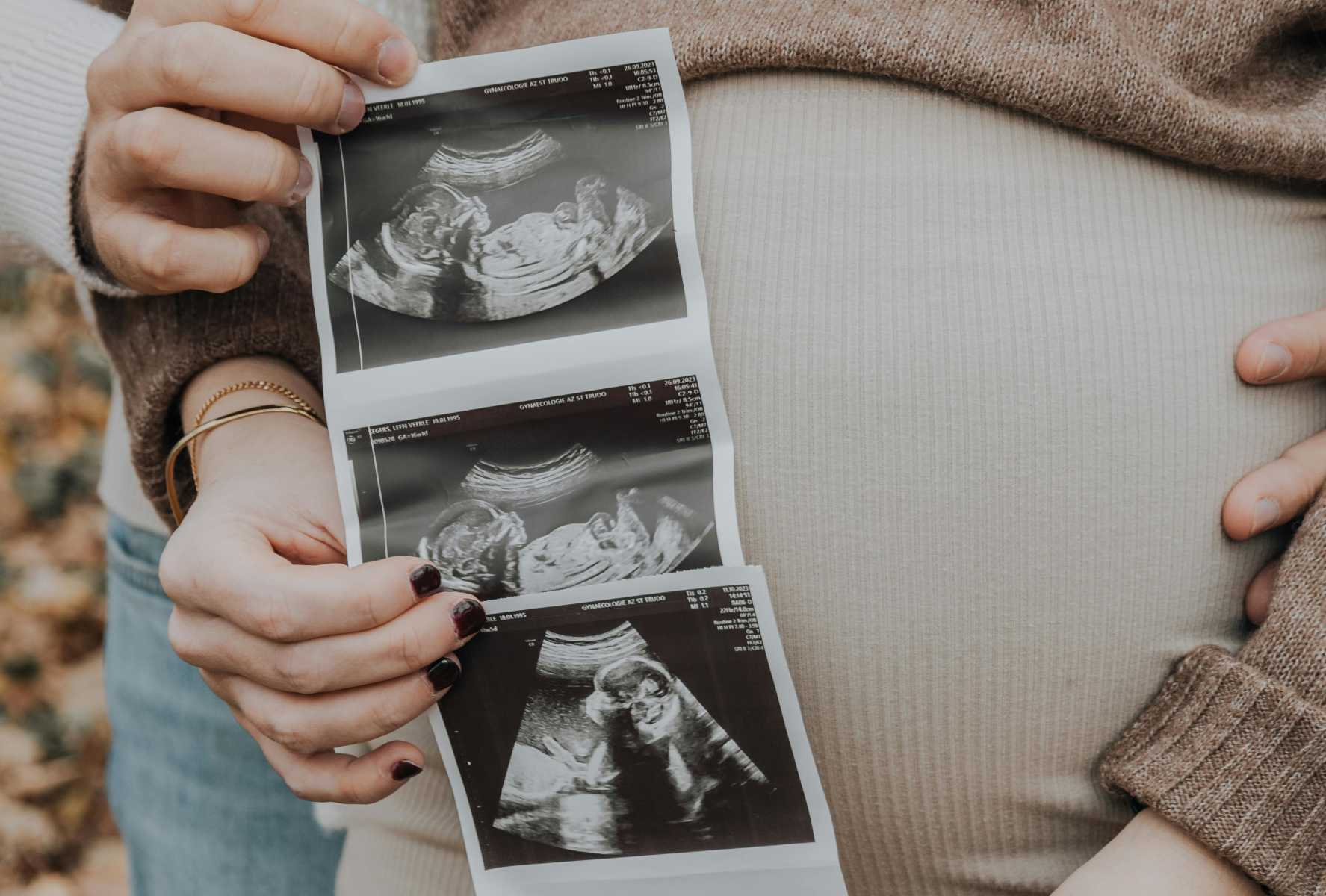 Otvorene s gynekologičkou - pýtame sa live