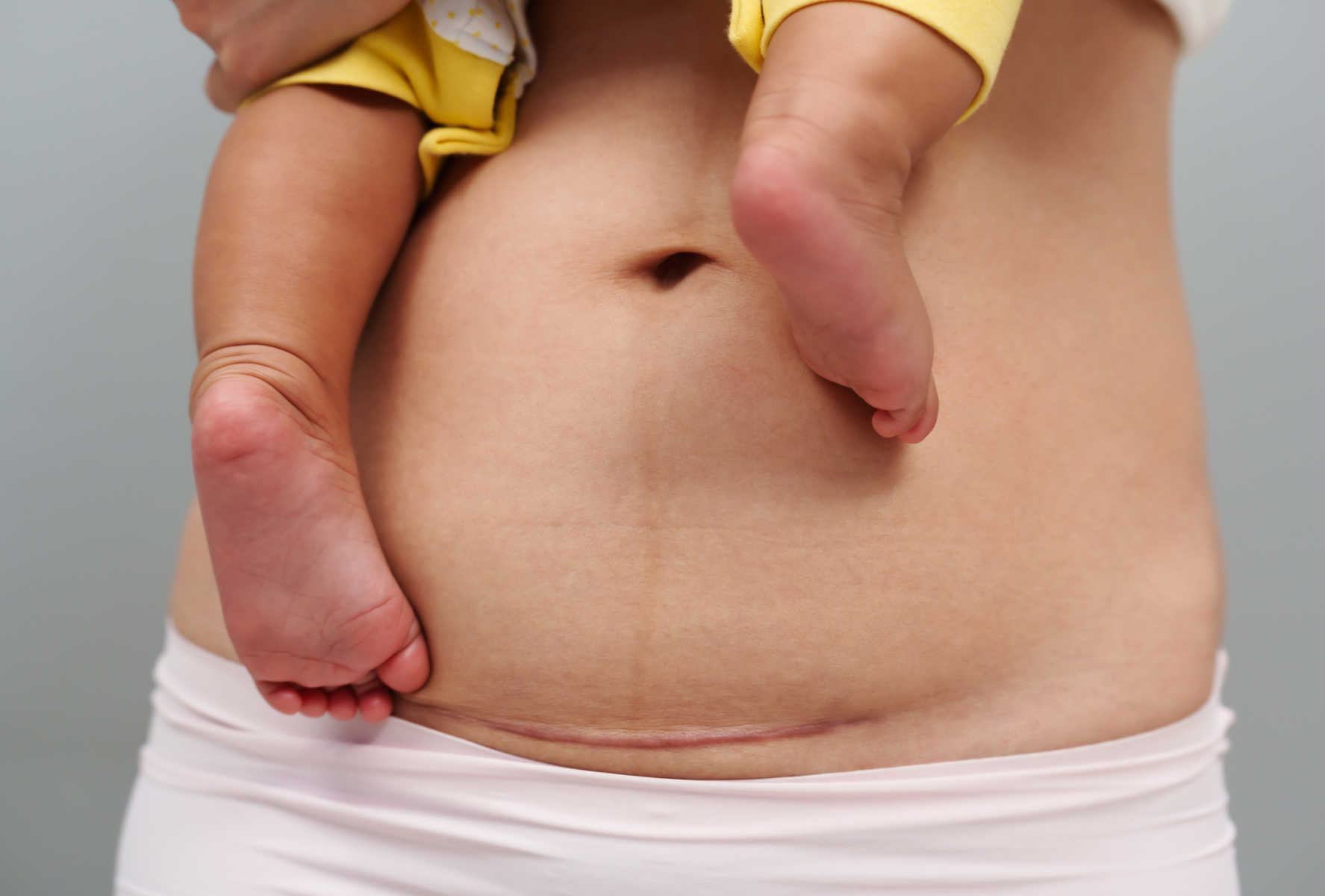 Celý priebeh tehotenstva s gynekologičkou