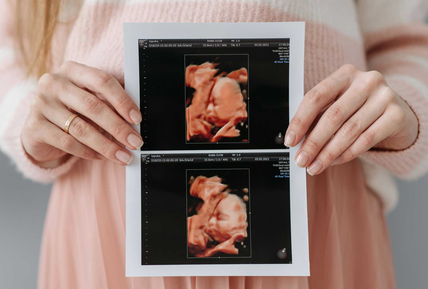 Pôrod v rukách lekárky – gynekologičky